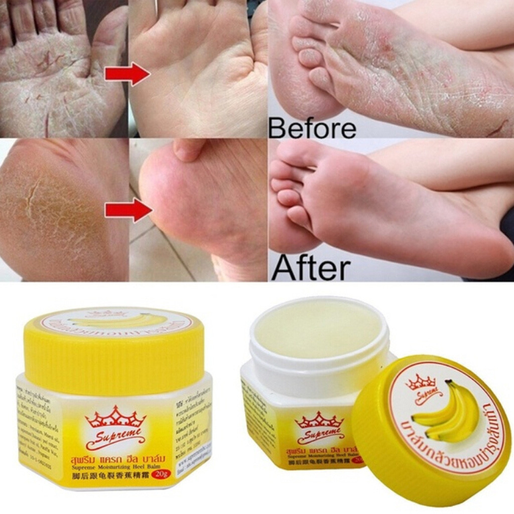 anti chapped anti-drying crack cream dead skin remover banana