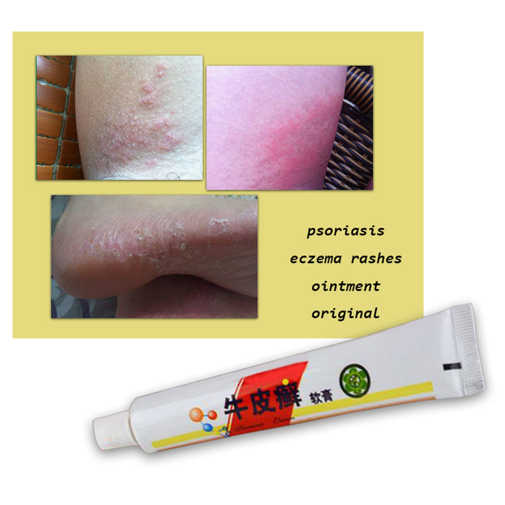 Los champúes medicinales de la psoriasis sobre la cabeza