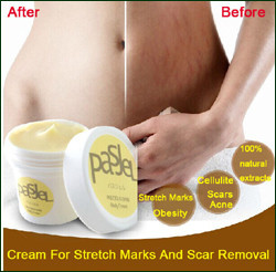 Cream-For-Stretch-Marks-And-Scar-Removal-Powerful-To-Stretch-Marks-Maternity-Skin-Body-Repair-Cream