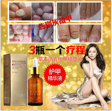 2pcs SnazII Fungal Nail Treatment Essence Nail and Foot Whitening Toe Nail Fungus Profession Removal Feet