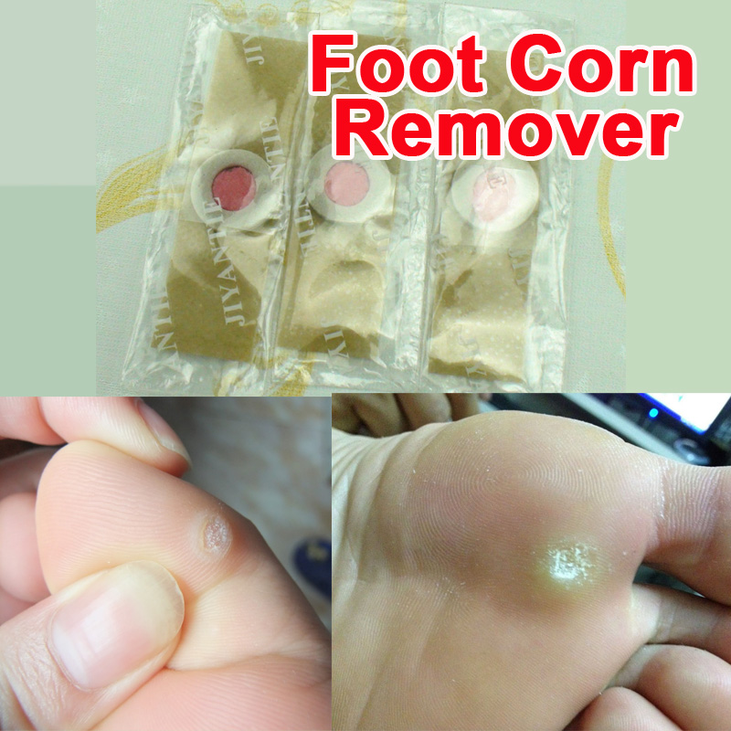 Image of Hot sale Detox Foot Pads Patches Feet Care Medical Plaster Foot Corn Removal Remover Plaster Relieving Pain Foot Massager C027