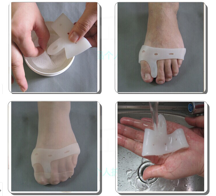Купить Подробнее о ноги боли ног сепараторы носилках hallux valgus ...