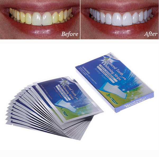 teeth whitening strips price