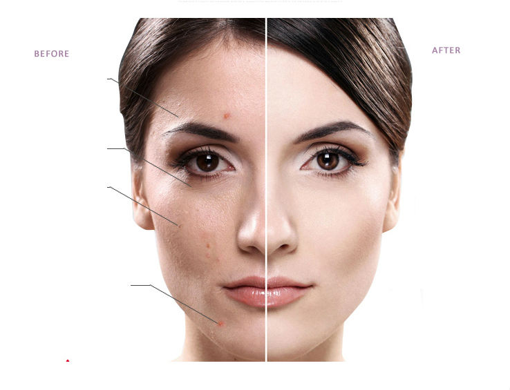 TB2zANrcVXXXXXVXpXXXXXXXXXX-2028477456