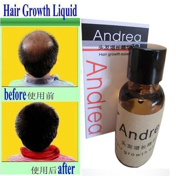 Image of Promotion! Andrea Hair Growth anti Hair Loss Liquid 20ml dense hair fast sunburst hair growth grow