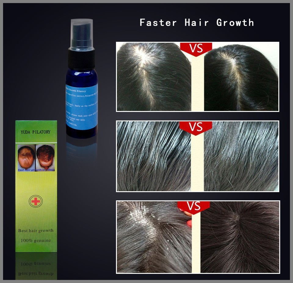 2-bottles-Lanthome-SIDEBURNS-EYEBROW-Thick-Hair-Growth-Liquid-30ml-Fast-Hair-Growth-Products-yuda-pilatory (2)