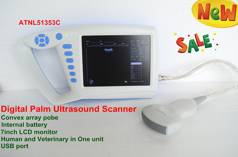 Palm ultrasound