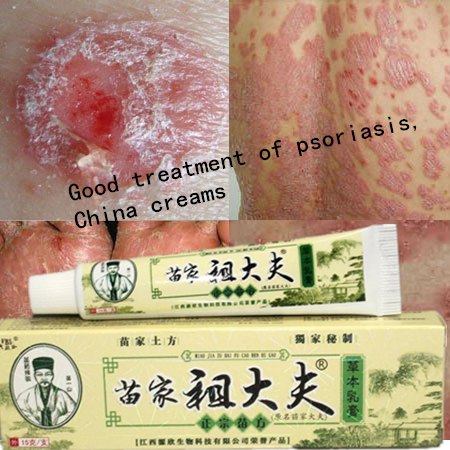Image of Psoriasis, dermatitis and eczema, pruritus psoriasis skin problems, China creams psoriasis creams