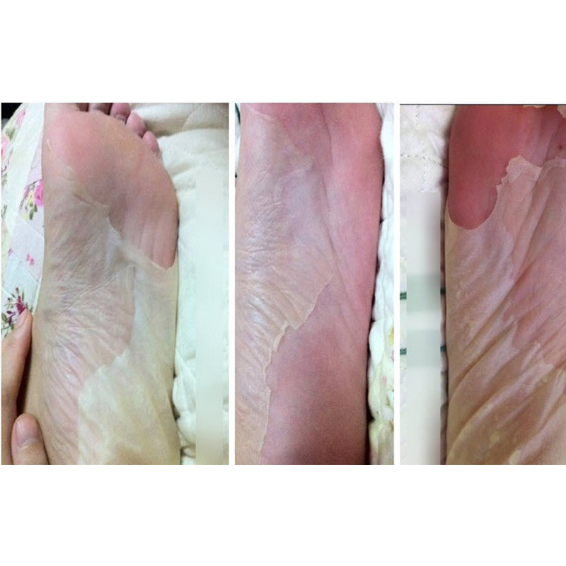 Exfoliant Masque Pied Achetez Des Lots Petit Prix Exfoliant Masque Pied Achetez Des Lots Petit Prix