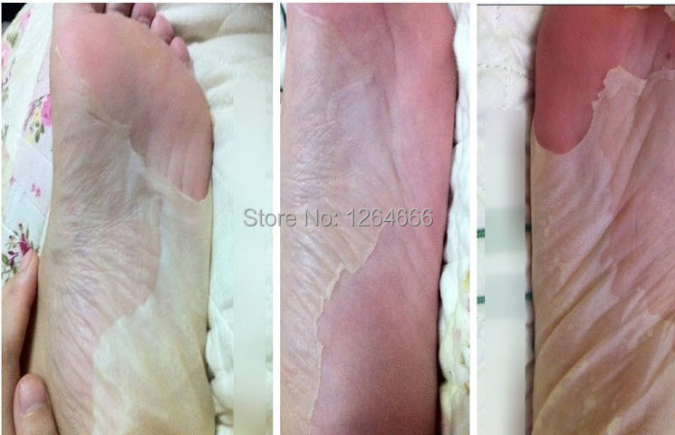 Image of 5pair=10pcs baby feet skin smooth exfoliating Foot Mask foot care mask foot care health care pedicure socks sosu Peeling Foot