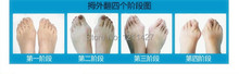 Free shipping 2014 New Hotsale Beetle crusher Bone Ectropion Toes outer Appliance Professional Health Care Product