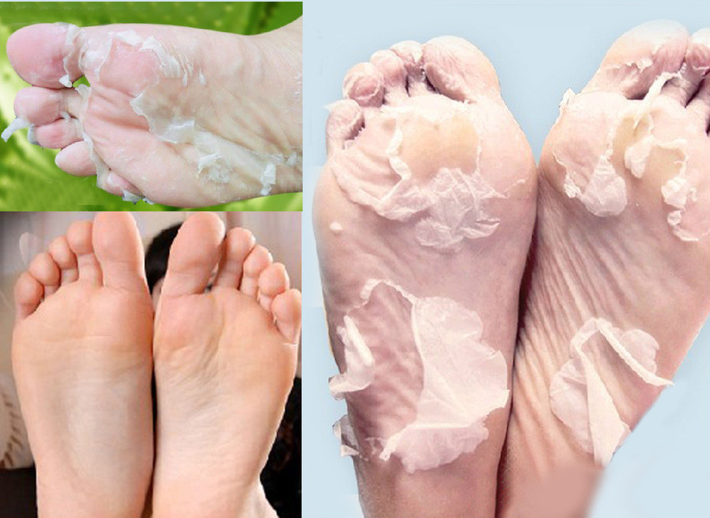 1369131905300_2pairs-4pcs-Free-shiping-Milk-bamboo-vinegar-remove-dead-skin-foot-skin-smooth-exfoliating-feet-mask